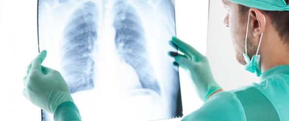 El Doctor analizando y observando una radiografía de tórax